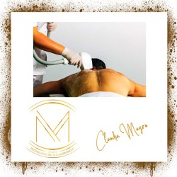 Depilación de espalda completa